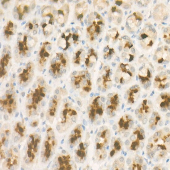 Pepsinogen C/PGC/Progastricsin Antibody (10Q1X2)