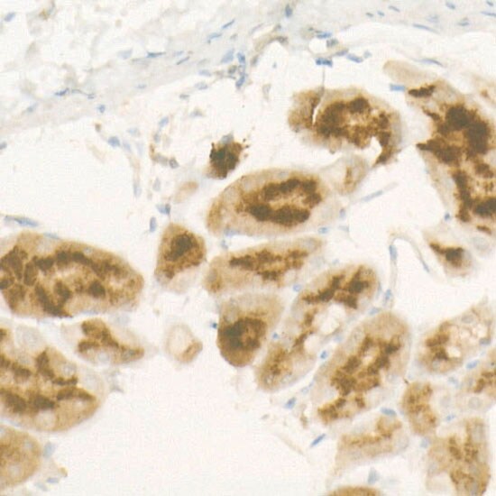 Pepsinogen C/PGC/Progastricsin Antibody (10Q1X2)