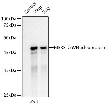 MERS-CoV Nucleoprotein Antibody (5H5T6)