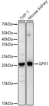 Glutathione Peroxidase 1/GPX1 Antibody (9E5H3)