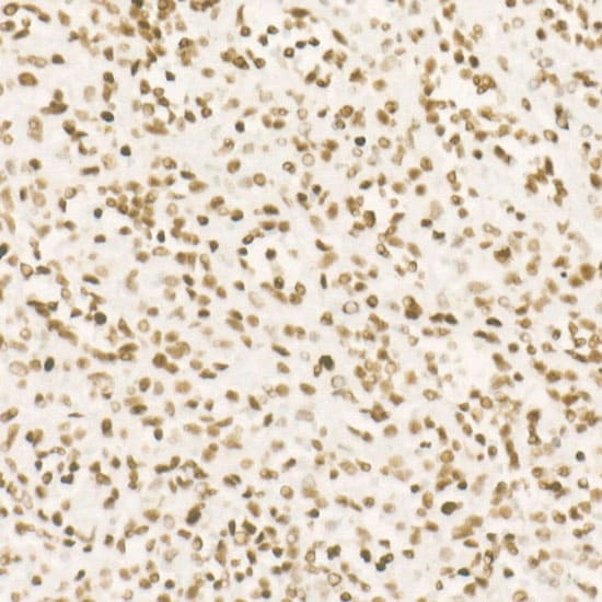 CDK12 Antibody (9X2D10)