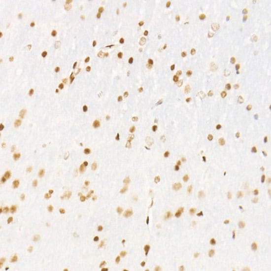 CDK12 Antibody (9X2D10)