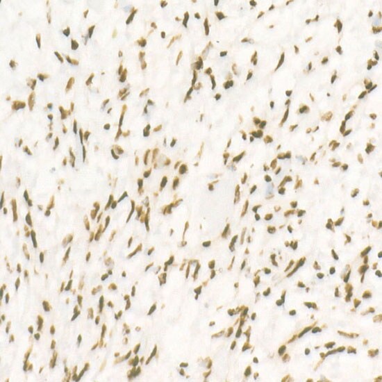 CDK12 Antibody (9X2D10)