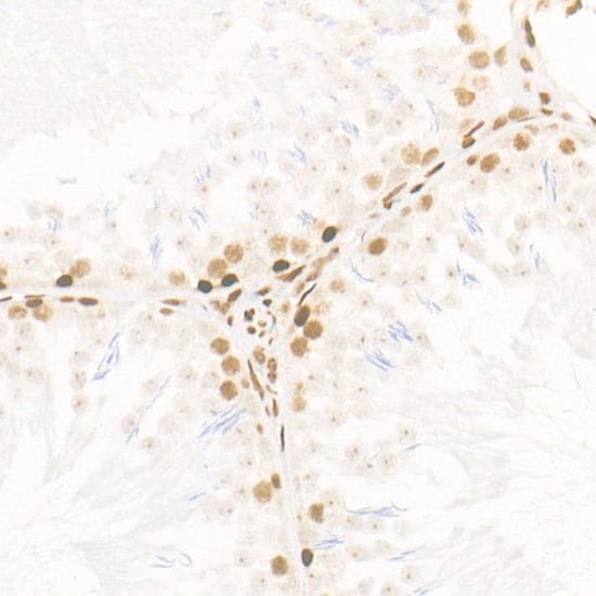 CDK12 Antibody (9X2D10)
