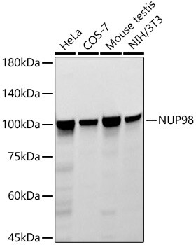 NUP98 Antibody (6M6V6)