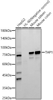 TAP1 Antibody (6Q8Q5)