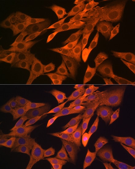 SRP54 Antibody (1O3J1)