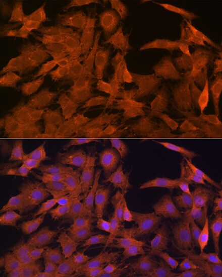 SRP54 Antibody (1O3J1)