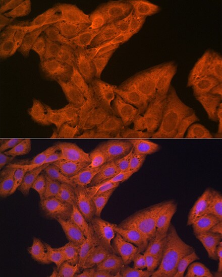 SRP54 Antibody (1O3J1)
