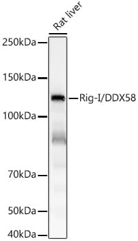 RIG-I Antibody (3E1C6)