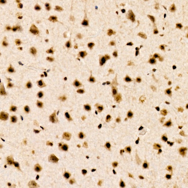 CHD4 Antibody (0M3R5)