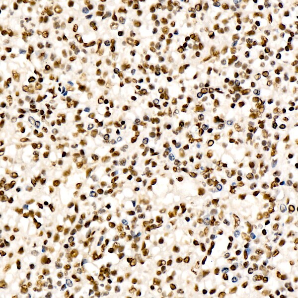 CHD4 Antibody (0M3R5)