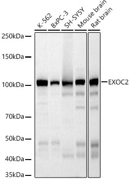 EXOC2 Antibody (5S2X9)