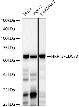 CDC73/HRPT2 Antibody (1B8Q1)