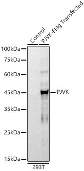 Pejvakin Antibody (10R1X6)