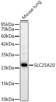 SLC25A20 Antibody (3J1L5)