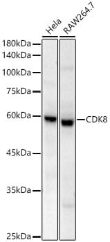 CDK8 Antibody (2P3P8)