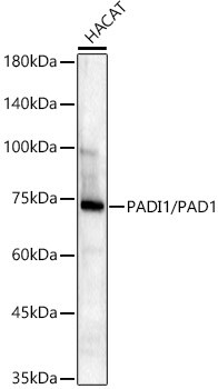 PADI1 Antibody (8M9P3)