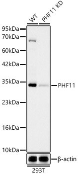 PHF11 Antibody (1J3E4)
