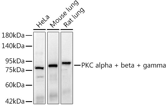 PKC Alpha/Beta/Gamma Antibody (9O5J1)