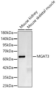 N-Acetylglucosaminyltransferase III/MGAT3 Antibody (4R7E2)