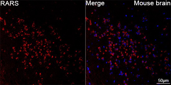 Arginyl tRNA synthetase Antibody (4Y1H4)