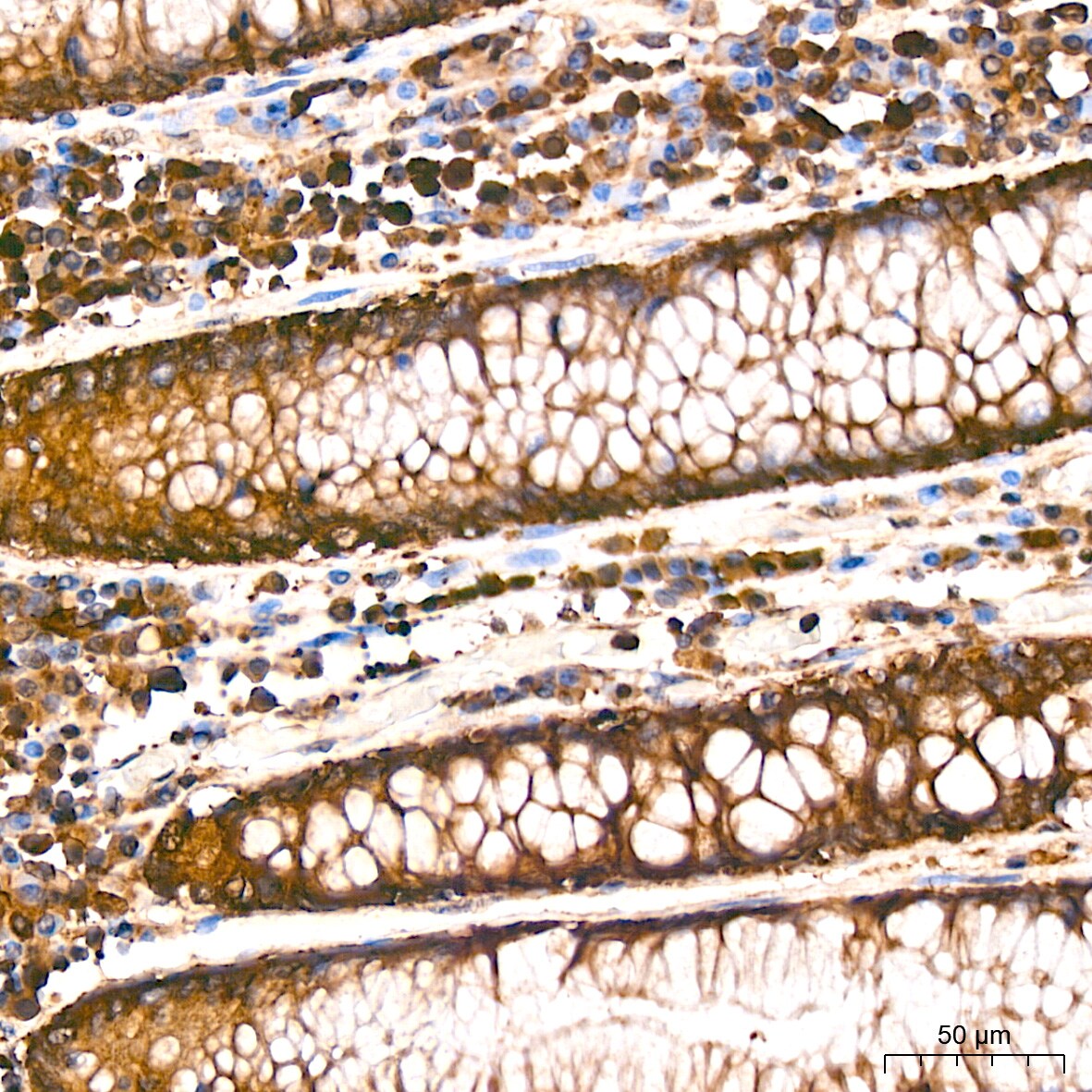 Arginyl tRNA synthetase Antibody (4Y1H4)