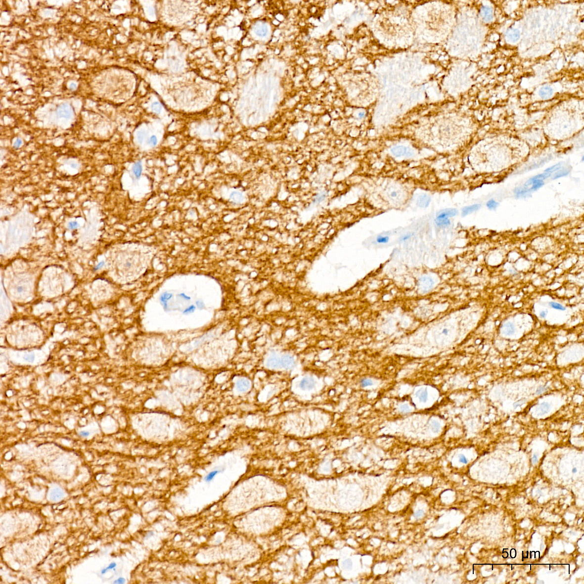 Trk (pan) Antibody (8A7M10)