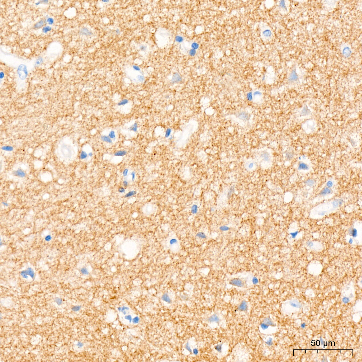 Trk (pan) Antibody (8A7M10)