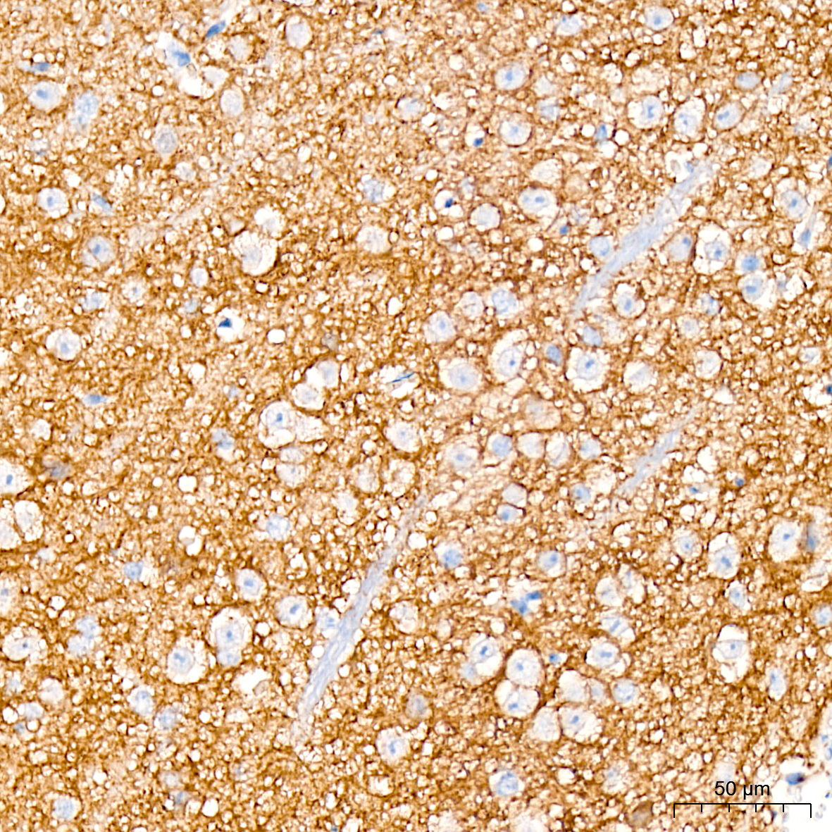 Trk (pan) Antibody (8A7M10)