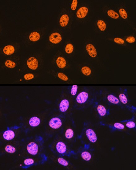 SFPQ Antibody (8Y5S6)