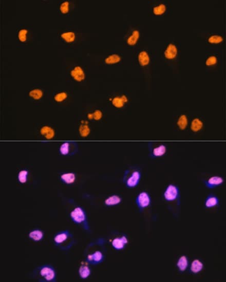 SFPQ Antibody (8Y5S6)
