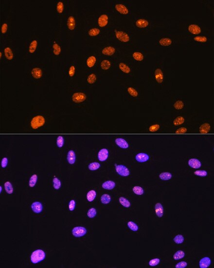 SFPQ Antibody (8Y5S6)