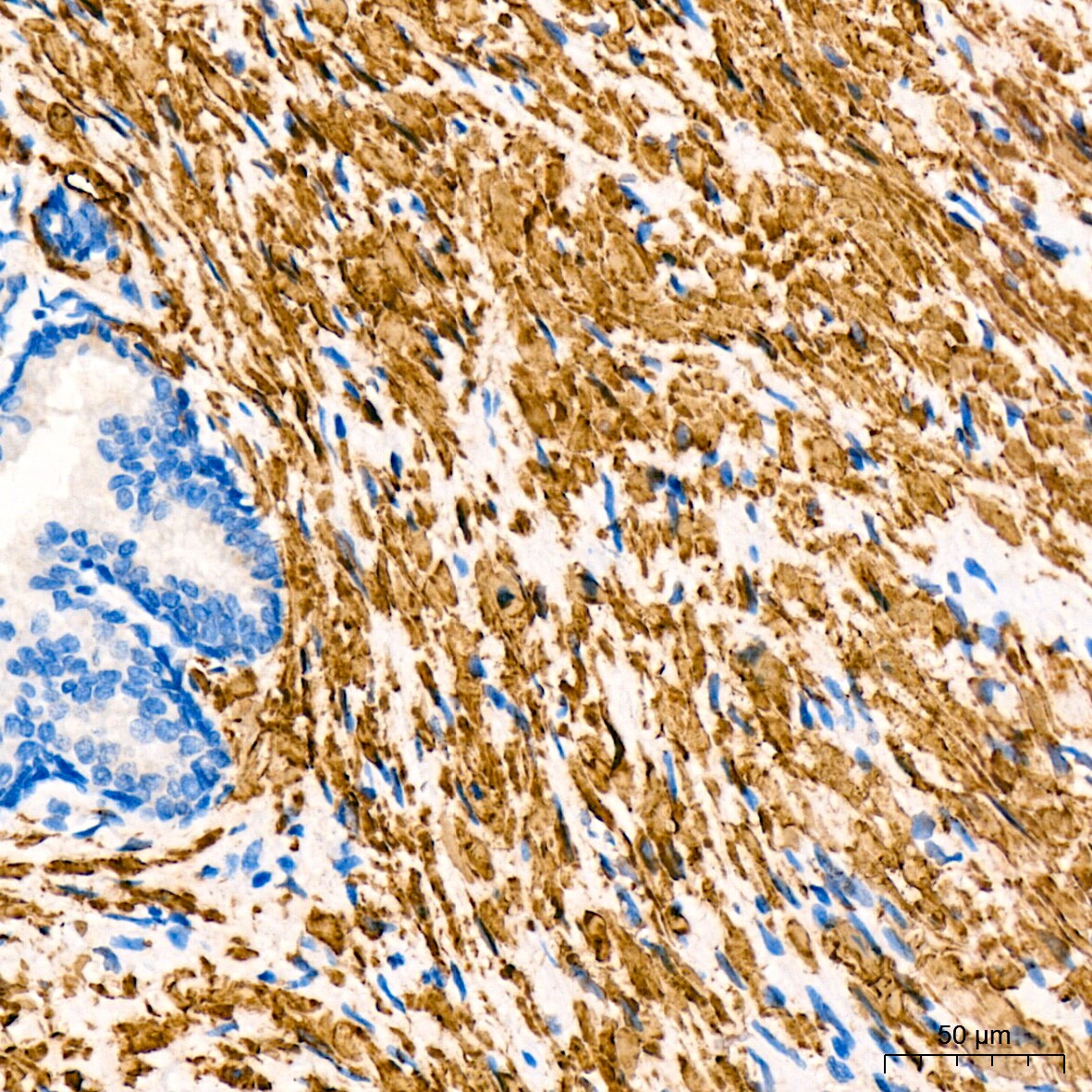Desmin Antibody (6O9O4)
