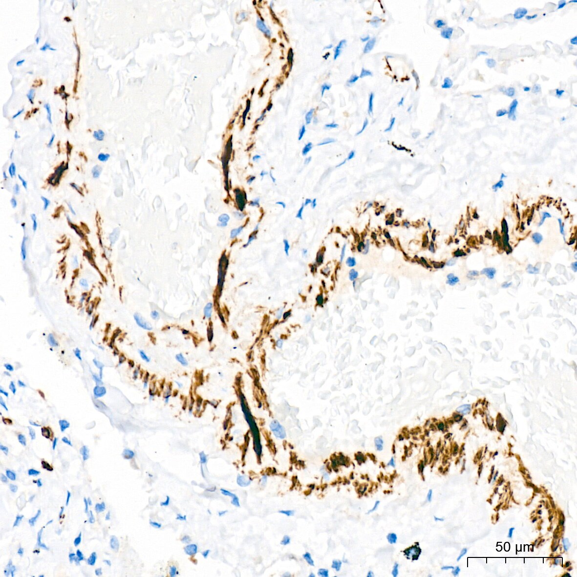 Desmin Antibody (6O9O4)