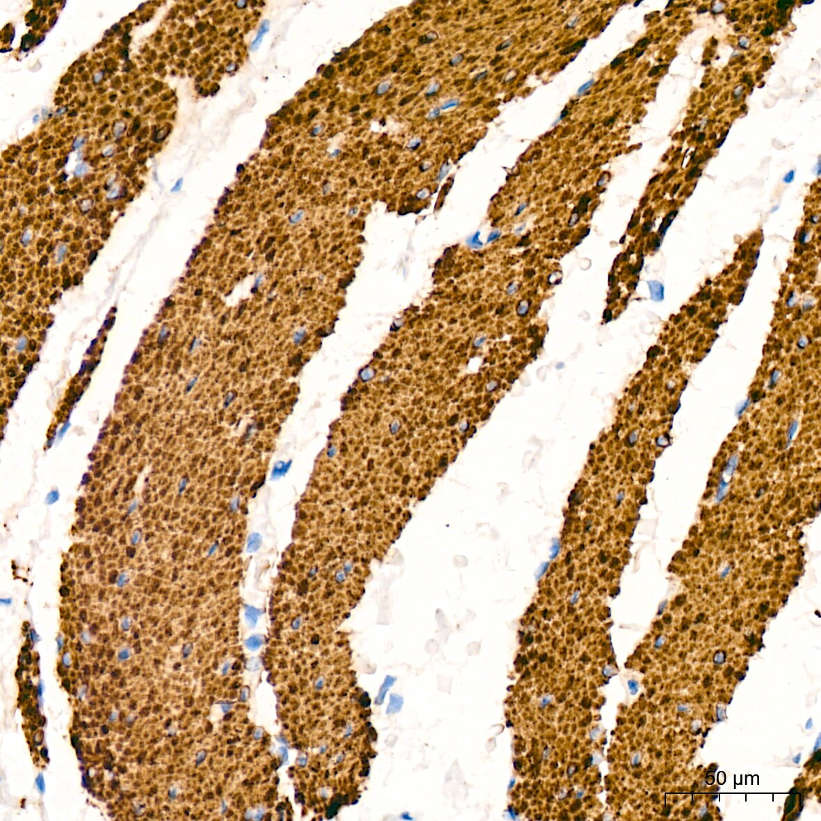 Desmin Antibody (6O9O4)