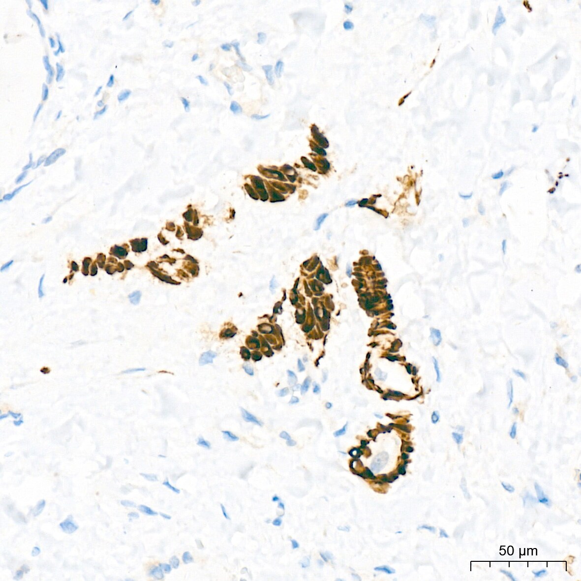 Desmin Antibody (6O9O4)