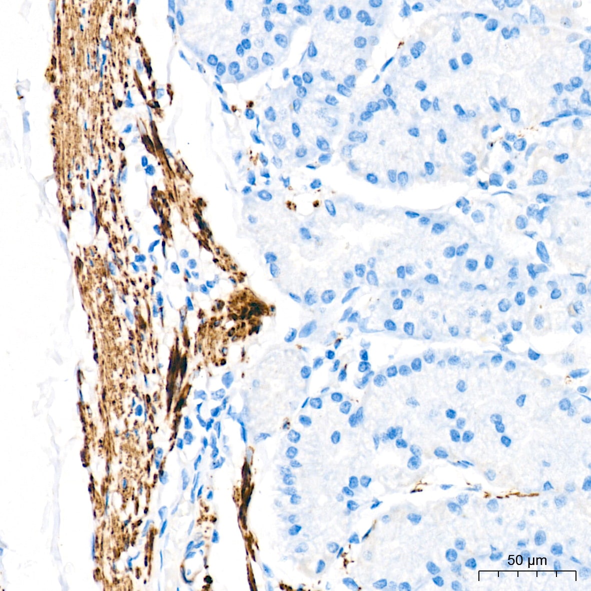 Desmin Antibody (6O9O4)