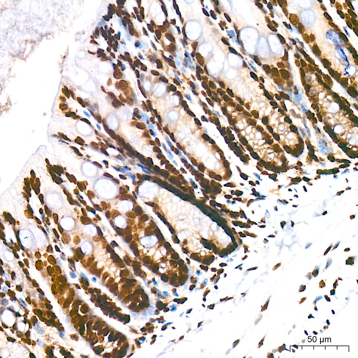Histone H2AE [Hydroxy Tyr39] Antibody (2J2Q7)