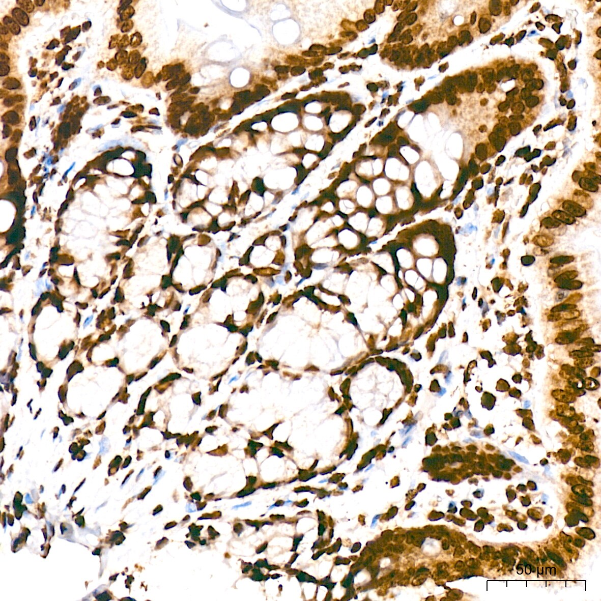 Histone H2AE [Hydroxy Tyr39] Antibody (2J2Q7)