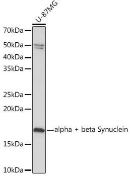 Synuclein alpha/beta Antibody (9E9X5)