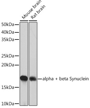 Synuclein alpha/beta Antibody (9E9X5)