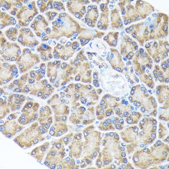 SPRY2 Antibody (10M8H1)