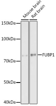 FUBP1 Antibody (1G6X5)