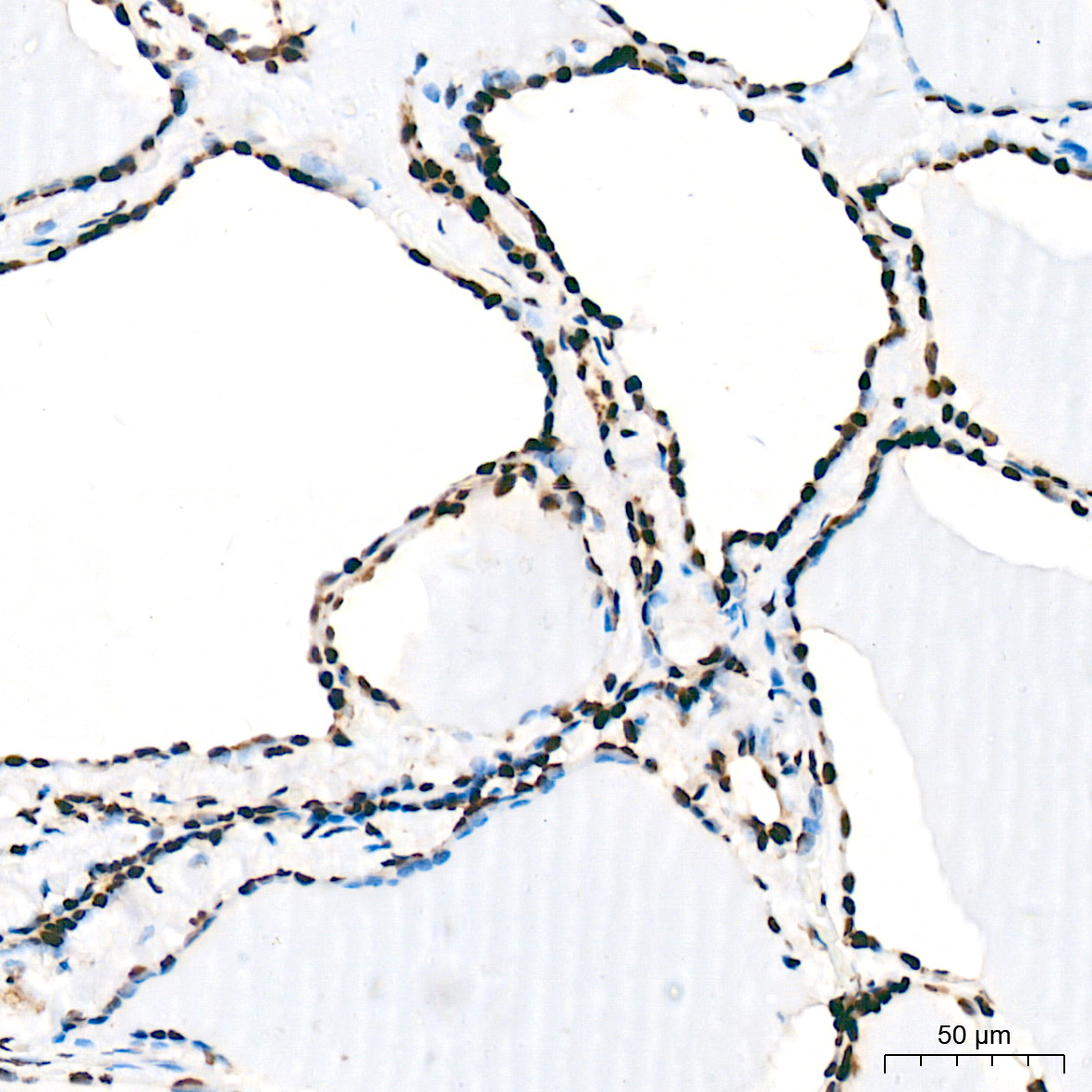 FUBP1 Antibody (1G6X5)