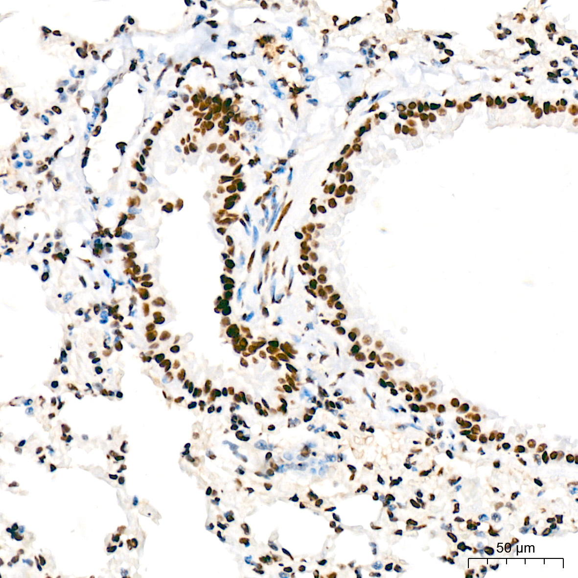 FUBP1 Antibody (1G6X5)
