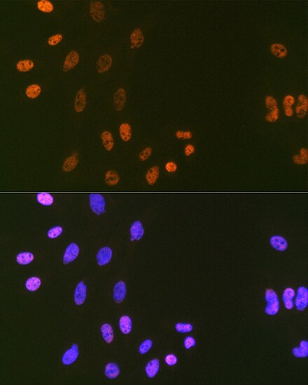 DNA Ligase I Antibody (0D6M4)