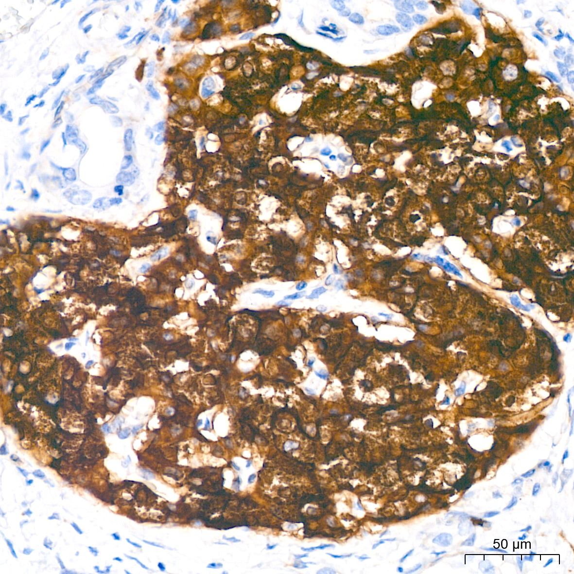 Syntaxin-BP1 Antibody (1N7U1)