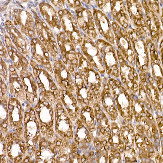 TXNDC12 Antibody (9J6L2)