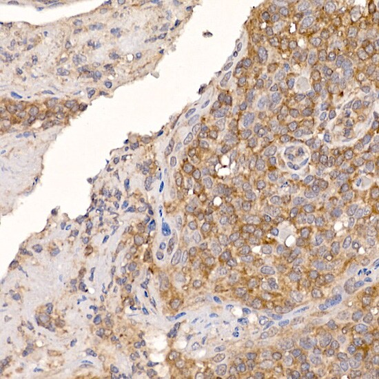 TXNDC12 Antibody (9J6L2)